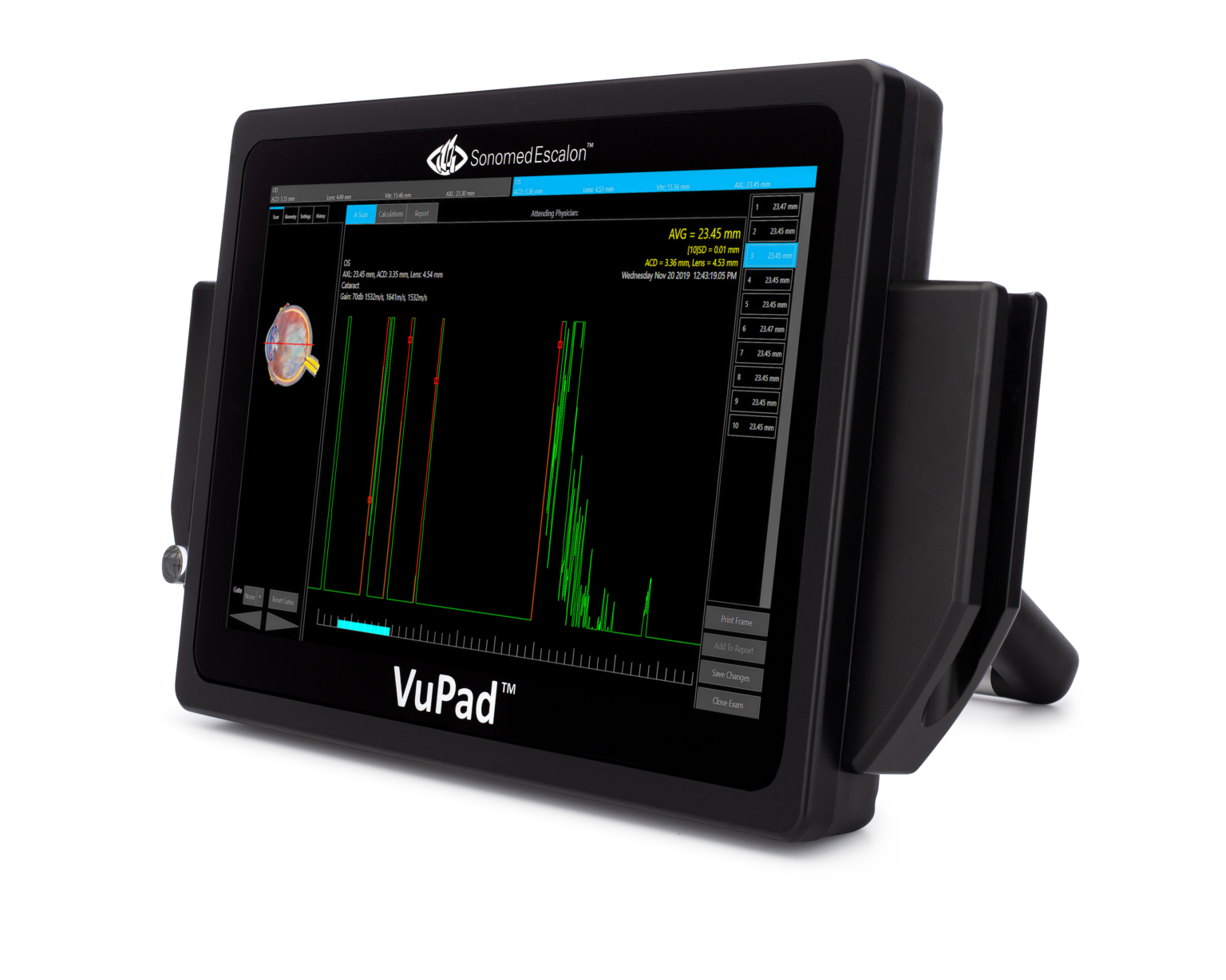 VuPad - Sonomed Escalon Ophthalmic Ultrasound - Birmingham Optical