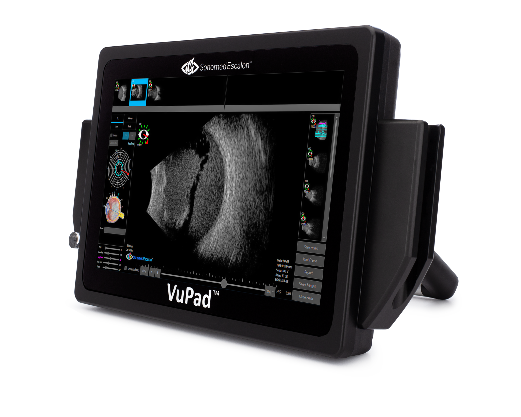 Sonomed Escalon VuPad Ophthalmic Ultrasound - Birmingham Optical