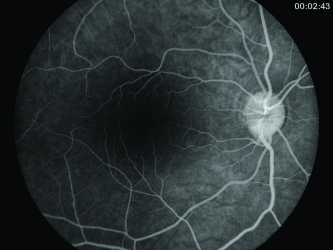 Volk Pictor Plus™ Non-Mydriatic Fundus Camera - Birmingham Optical